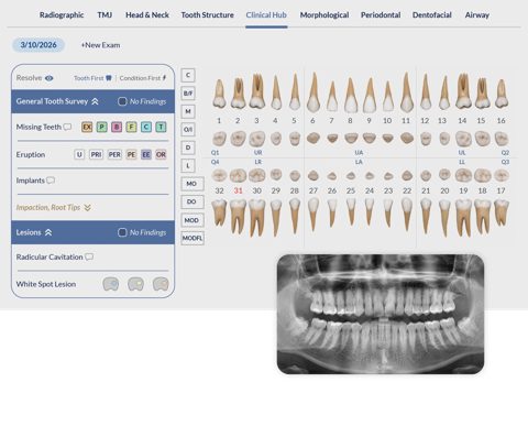 Oryx Dental Software screenshot: Clinical charting hub with tooth chart